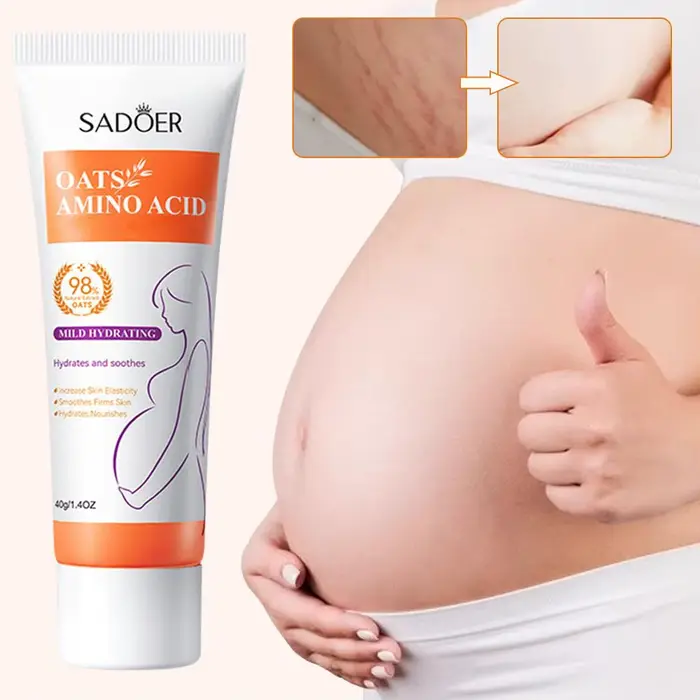Crème anti-vergetures pour éliminer l'obésité post-partum