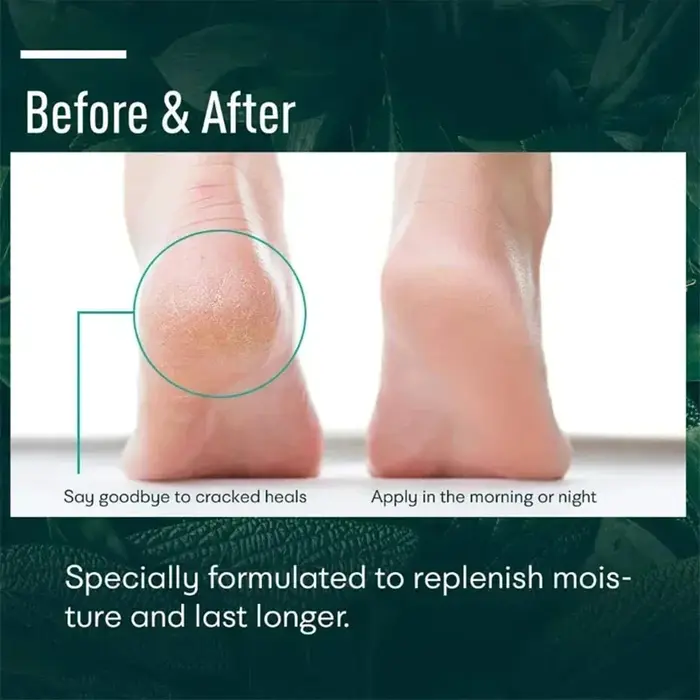 Crème Anti-fissure à base de plantes pour les pieds
