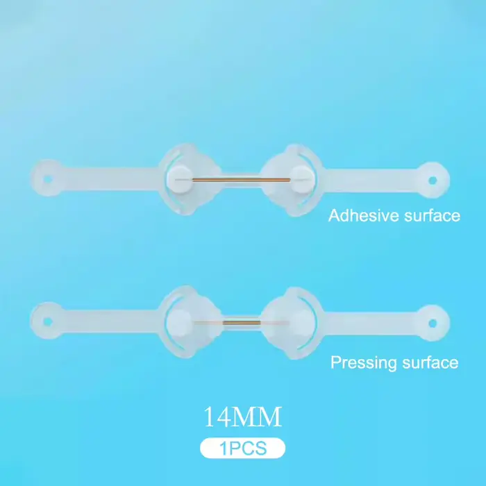 Correcteur d'ongles incarnés 12/14/16/18mm, traitement des ongles incarnés, Patch élastique autocoll