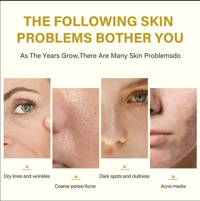 Huile exfoliante pour les taches de peau foncées