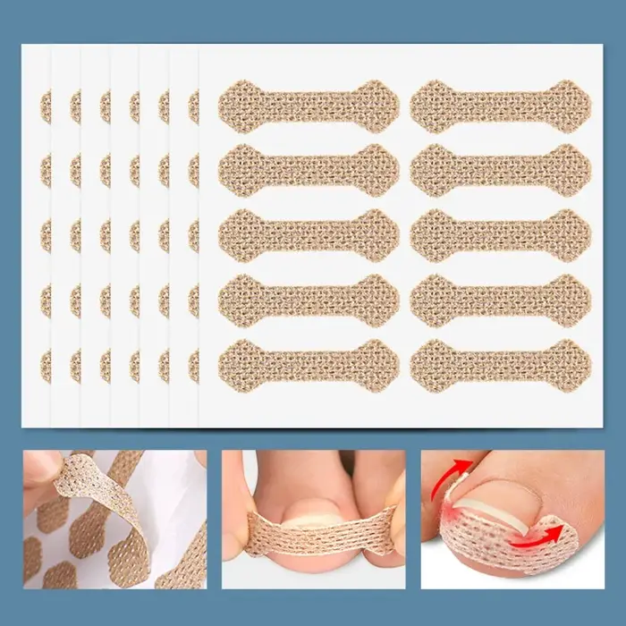 60 Bandes Correctrices Anti-Paronychie pour Ongles Incarnés, Patchs Anti-Encrochement pour Pieds, Pa