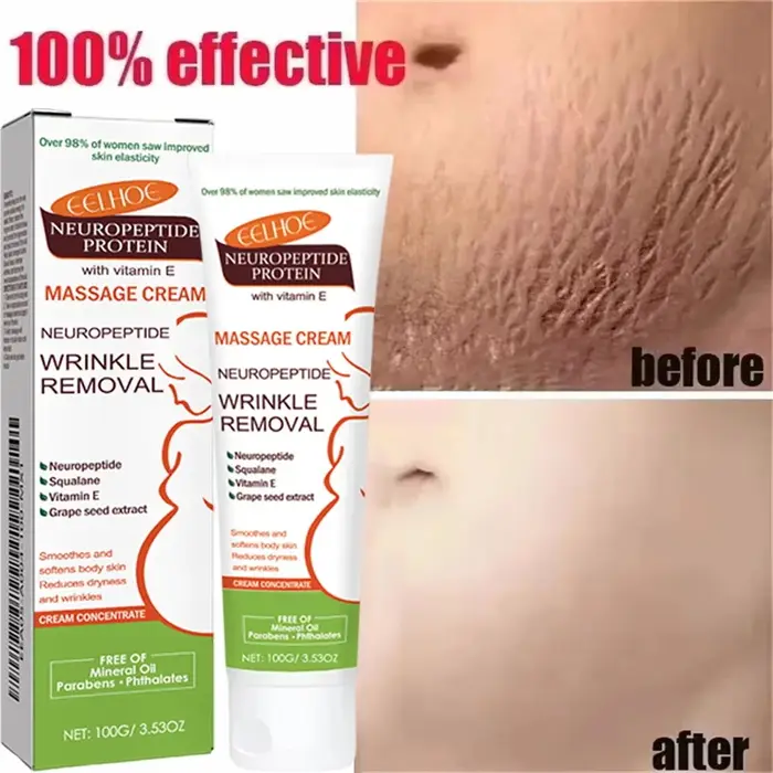 Crème anti-vergetures permanente 100g pour femmes enceintes