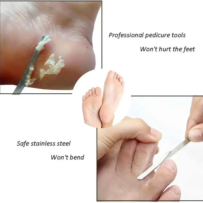 Grattoir exfoliant en acier inoxydable pour éliminer les callosités des pieds