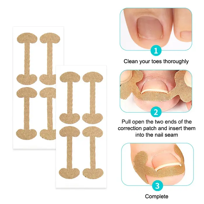 Correcteur professionnel des ongles incarnés – Autocollants de soin des pieds pour la protection