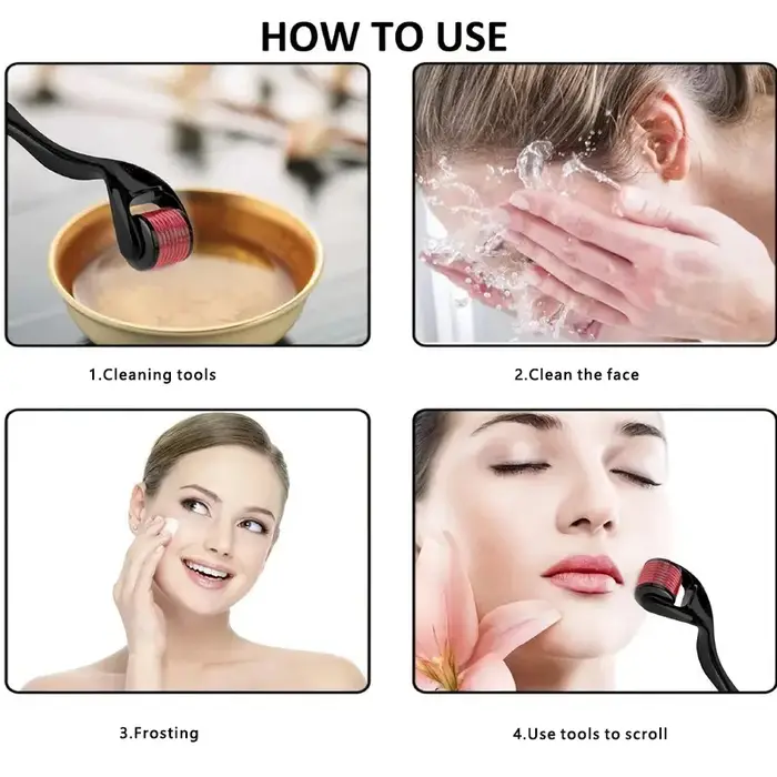 Rouleau de micro-aiguilles pour le visage