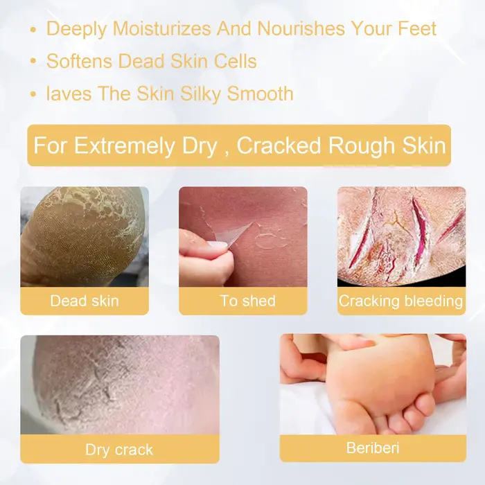 Ouhoe – Spray exfoliant pour les pieds