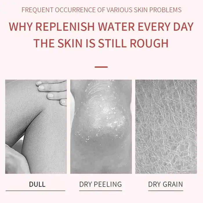 Crème anti-séchage pour les pieds