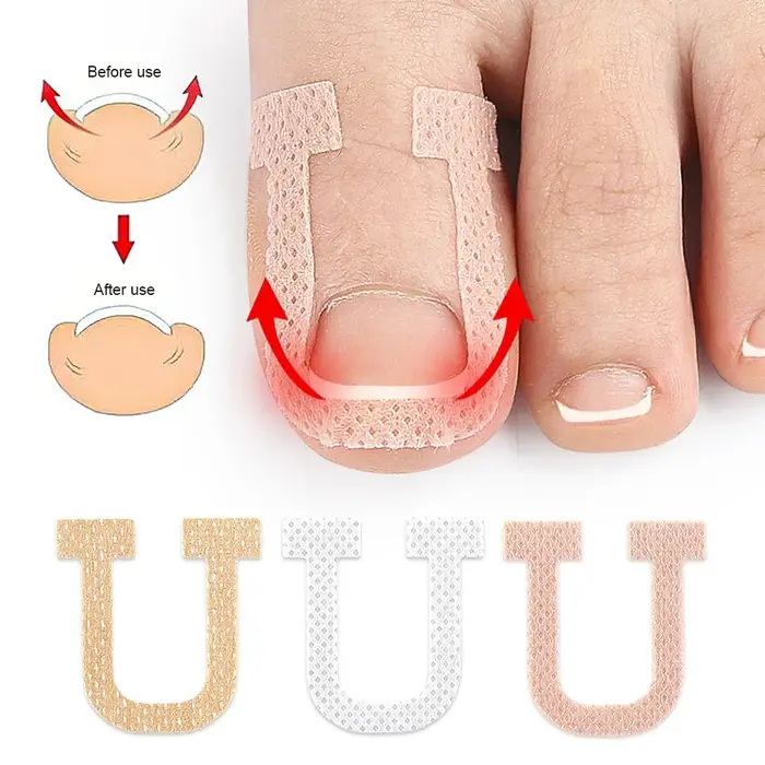 Autocollants de traitement des ongles incarnés