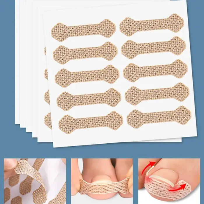 60 Bandes Correctrices Anti-Paronychie pour Ongles Incarnés