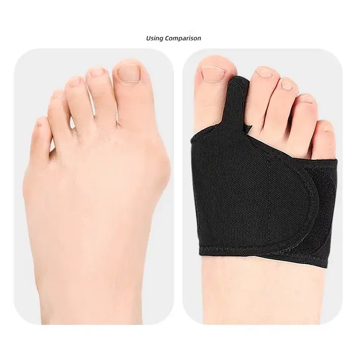 Coussinet pour l'avant-pied Hallux Valgus