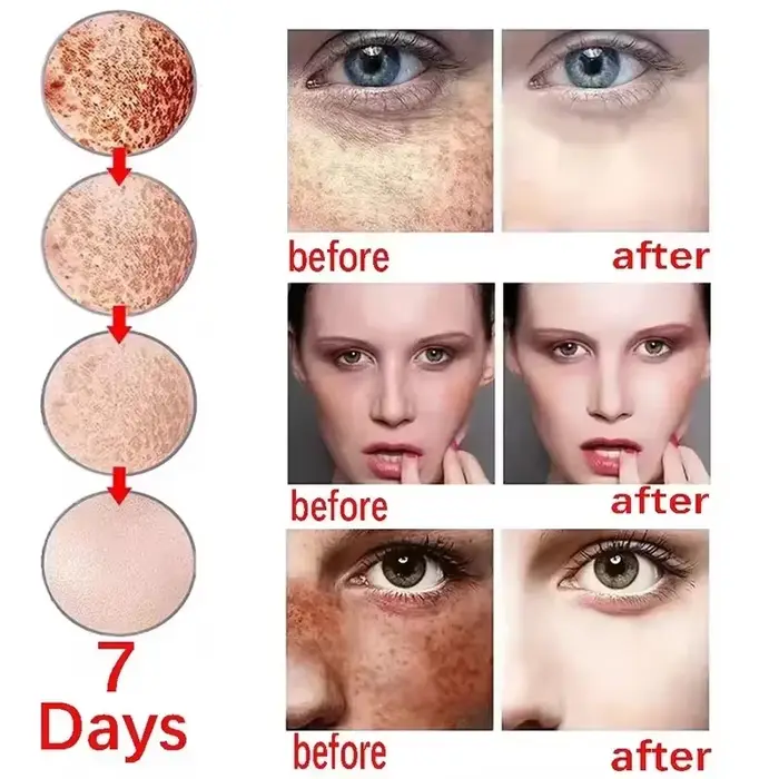 Crème blanchissante pour le visage