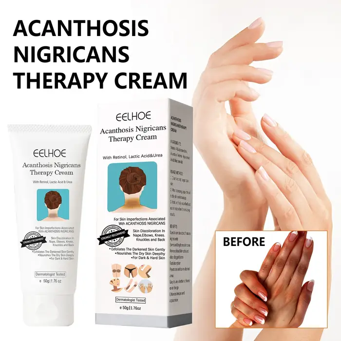 EELHOE crème blanchissante éclaircissante peau