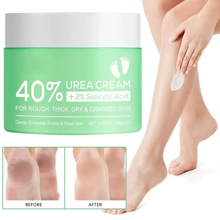 Crème à l'urée à 40% pour les mains et les pieds