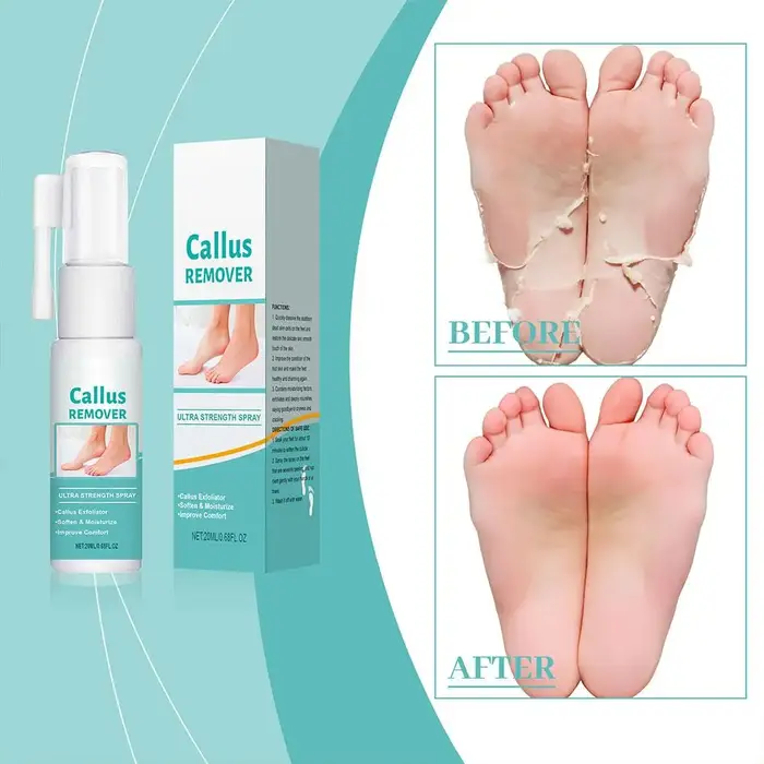 Spray exfoliant pour les pieds 20 ml