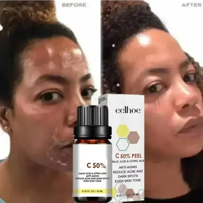 Huile exfoliante pour les taches de peau foncées