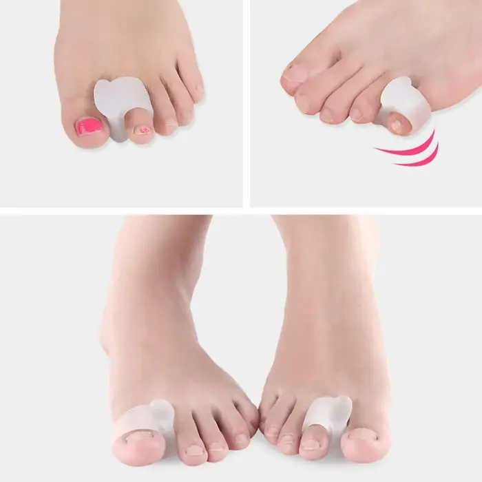 Orthèses protecteur os superposés pédicure 2 pièces anneau séparateur d'orteil oignon Hallux Valgus pouce Correction de Massage orthopédique