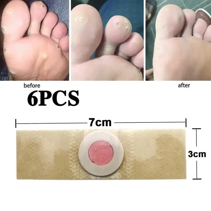 Nouveau 6 pièces soins des pieds protecteurs tampons callosités