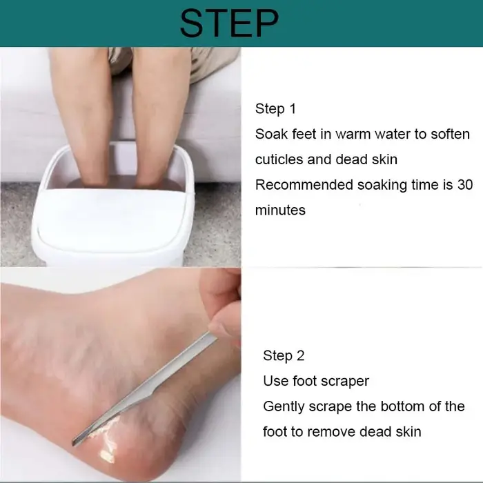 1 pièces manucure pédicure outils orteil ongles rasoir pieds