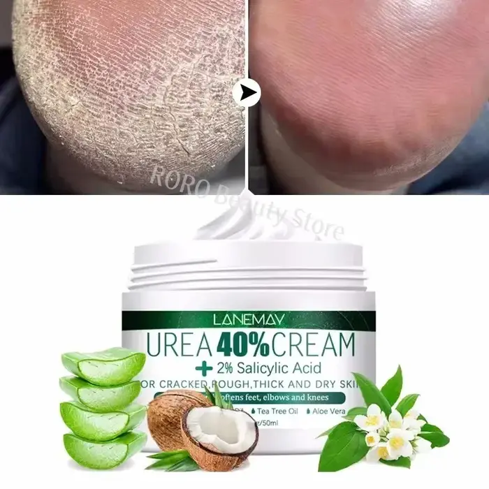 Crème Anti-fissure à base de plantes pour les pieds