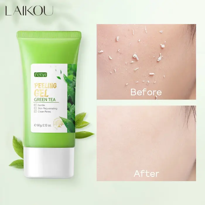 Gel exfoliant pour le visage, gommage hydratant, blanchissant, thé vert, élimine les points noirs, l