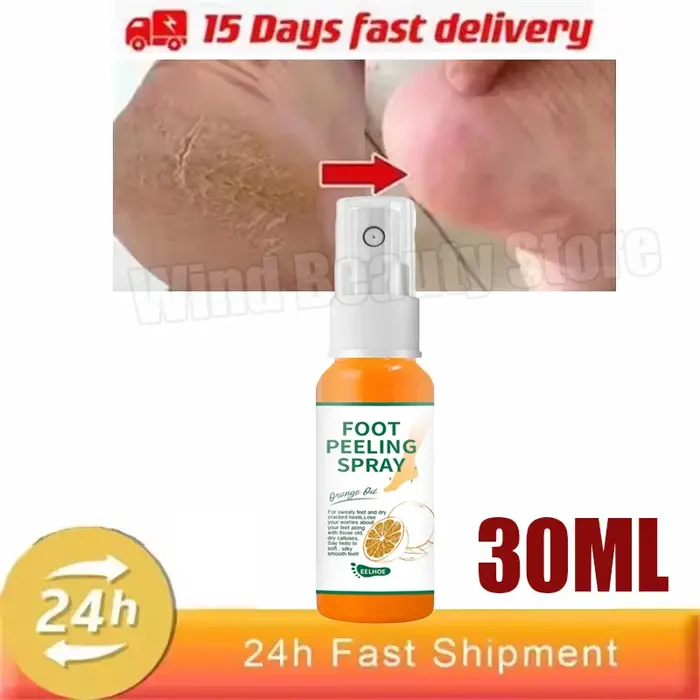 Crème Anti-fissure à base de plantes pour les pieds, Spray, produits de réparation pour les fissures