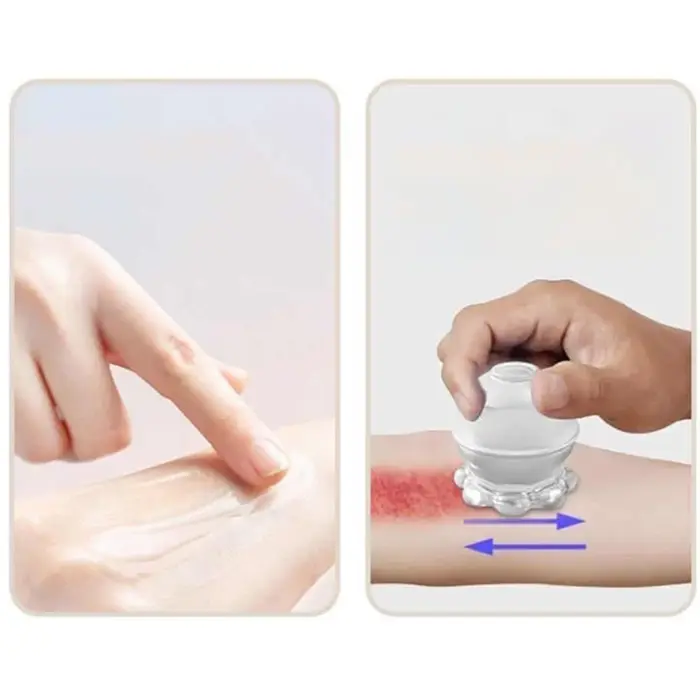 Ventouses de Massage Anti-Cellulite en Silicone