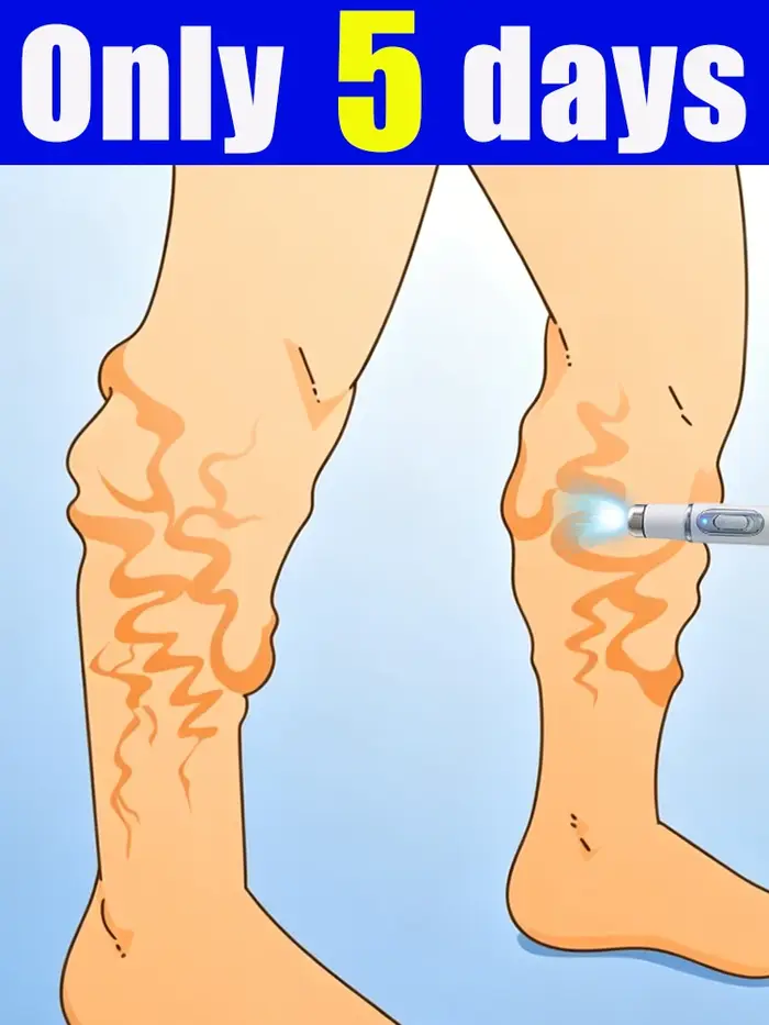 Appareils de soins des pieds et des jambes adaptés aux besoins de différents groupes