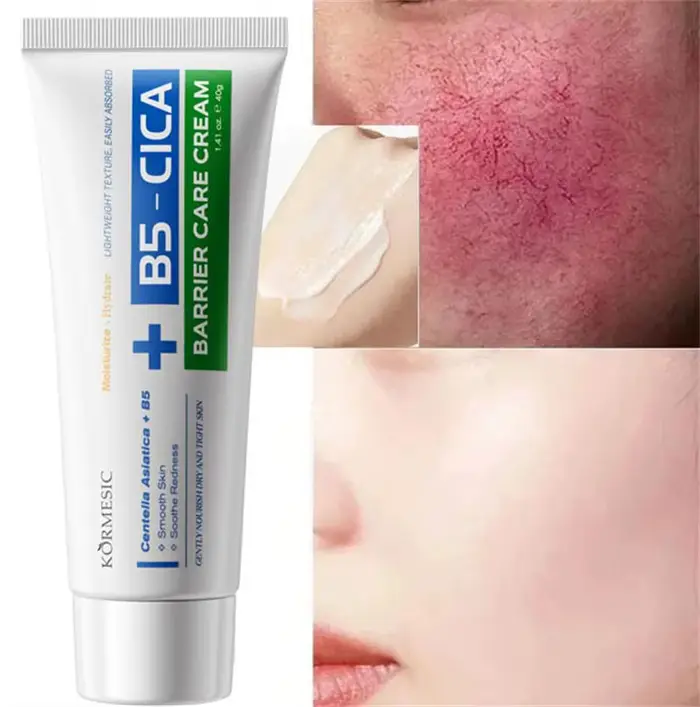 Crème Réparatrice B5 Hydratante Apaisante pour Peaux Sèches, Gercées et Rougeurs – Nourrit, Hydrate 