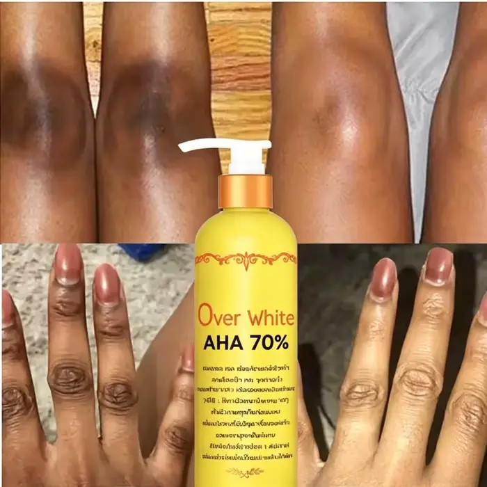 Sérum éclaircissant pour le corps AHA 70% - Élimine les taches sombres - Blanchiment - 120ml