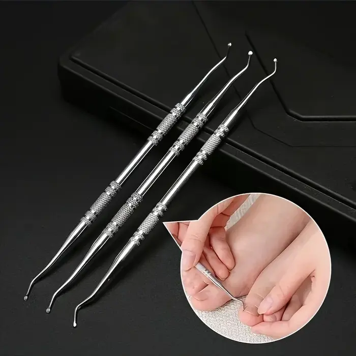 Correction professionnelle des ongles incarnés