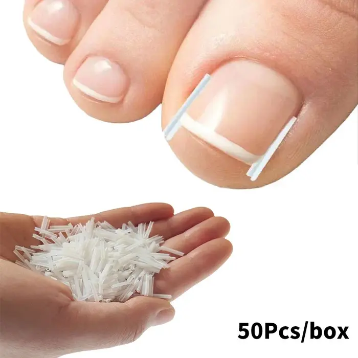 Correction des ongles des pieds