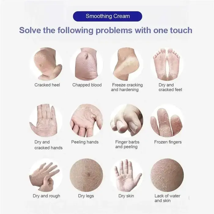 Crème anti-fissure pour les pieds