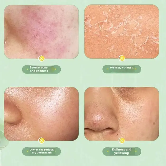 Gel d'aloe vera pour le visage et le corps