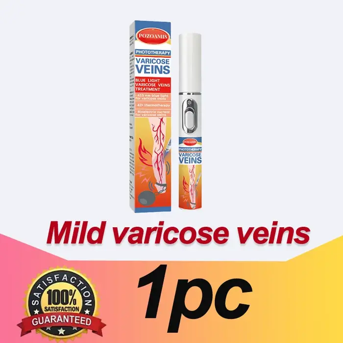 Promouvoir la circulation sanguine dans les varices
