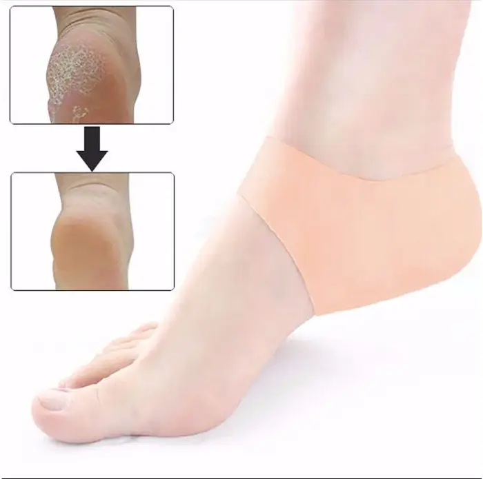 1 paire d'outils de soins des pieds gercés en Silicone