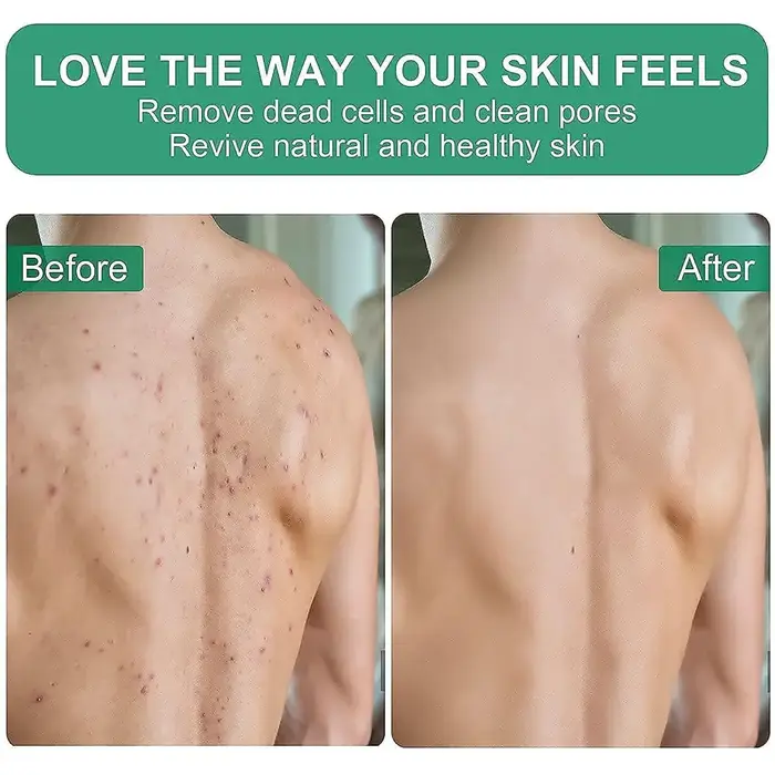 Gant exfoliant en profondeur