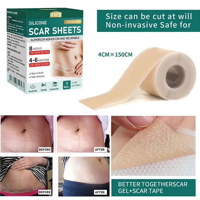 1 rouleau de feuilles de gel en silicone pour cicatrices