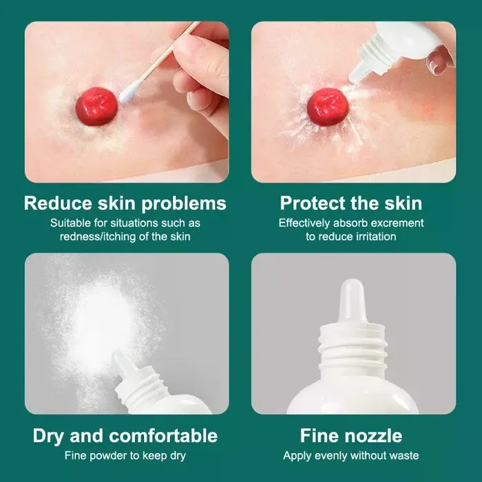 Farine de soins pour la peau, 25g, farine sèche, traitement médical pour le stomie, accessoire, sac