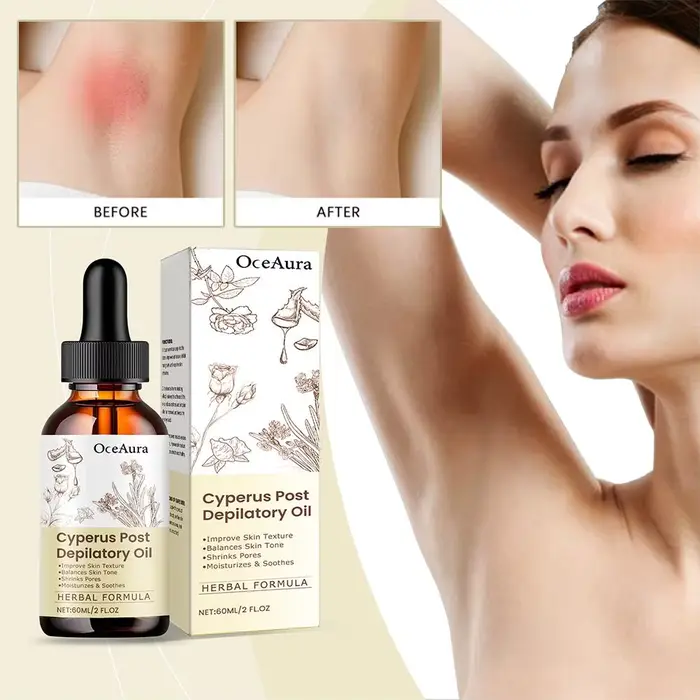 Huile Essentielle Naturelle de Cyperus Rotundus 60ml pour l'Épilation