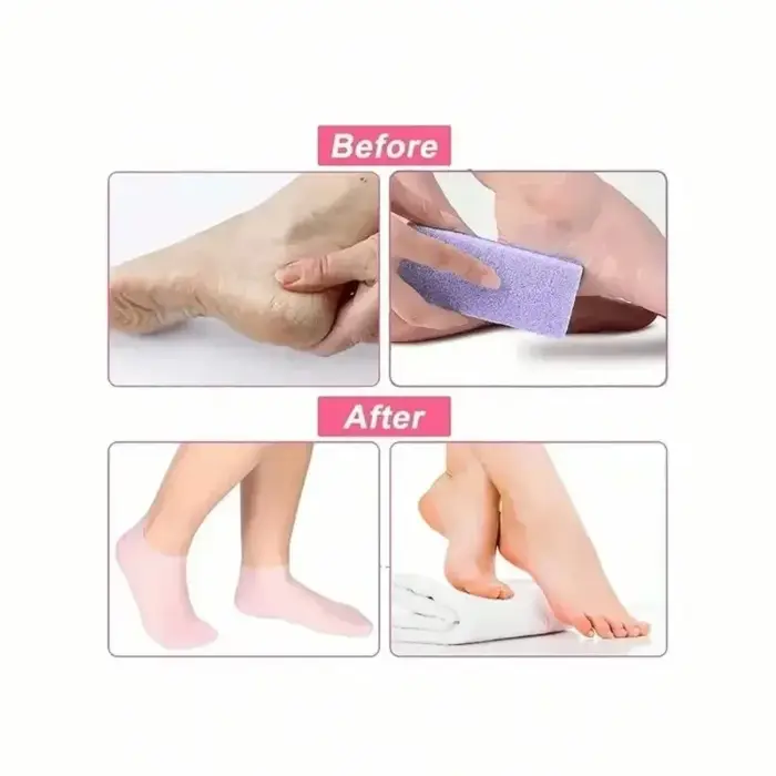 Chaussettes hydratantes en silicone pour pieds secs et gercés