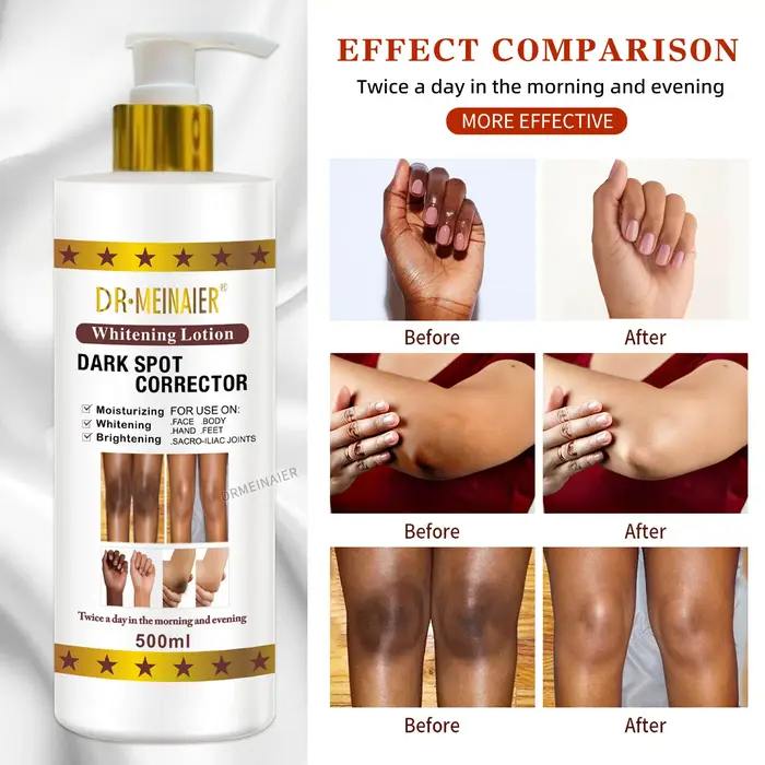 Lotion pour le corps éclaircissante végane 500 ml, avec AHA, niacinamide, hydratante, hydratation, p