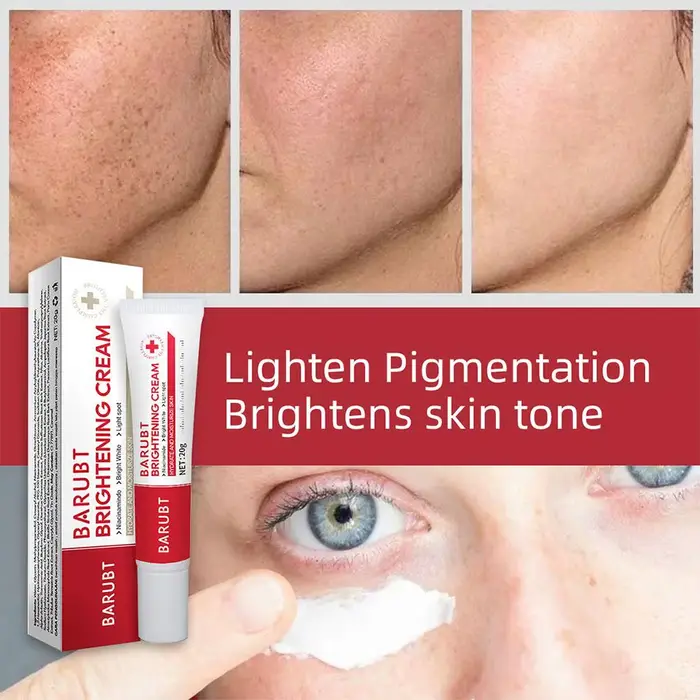 Crème Éclaircissante Anti-Taches pour le Visage – Correcteur de Mélasma et Taches Brunes – Atténue la Pigmentation de la Mélanine – Soin de Beauté Illuminateur