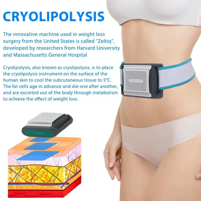 Cryothérapie pour dissoudre la graisse