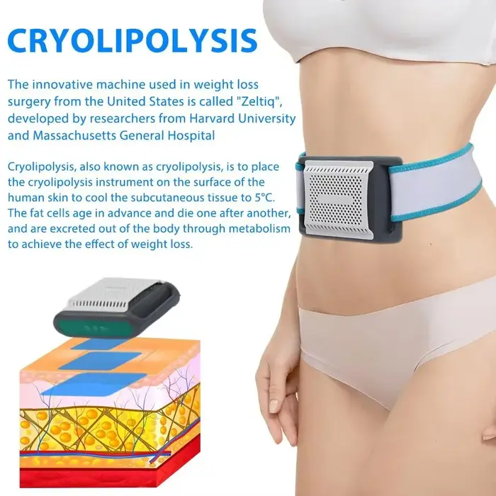 Appareil de cryolipolyse portable