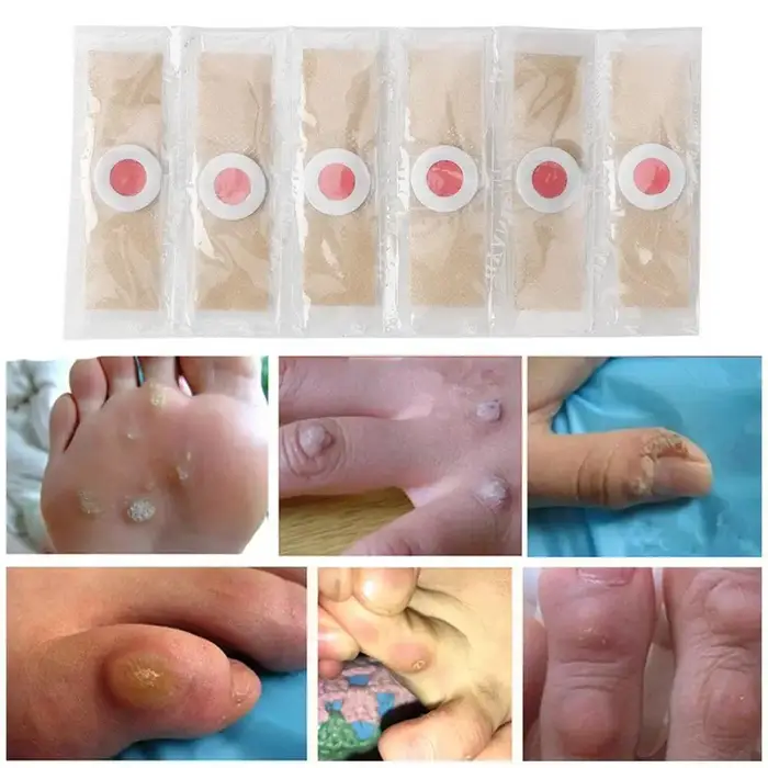 30 pièces/ensemble orteils et pieds protecteurs coussinets callosités