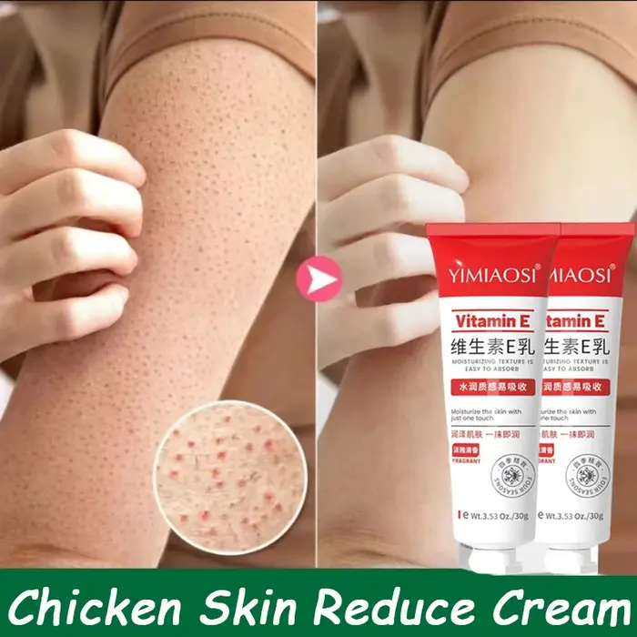 Crème Réparatrice Anti-Graine de Poule