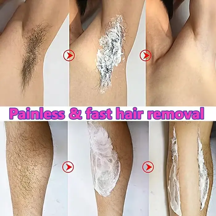 Crème d'épilation rapide indolore inhibiteur de croissance des cheveux bras aisselles jambes dépilatoire Permanent pour hommes femmes beauté soins de santé 60g
