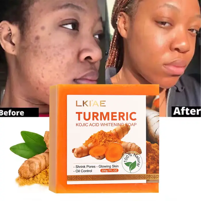 Crème blanchissante naturelle au curcuma pour le corps, nettoie en profondeur la peau, élimine les t