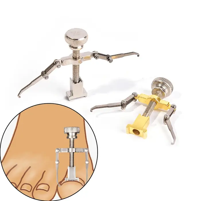 Correction professionnelle des ongles incarnés