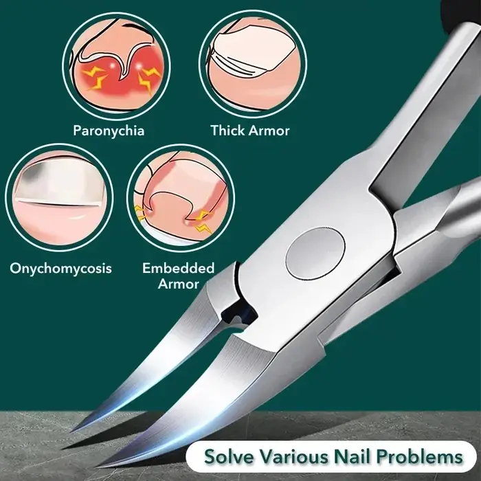 Kit professionnel correcteur d'ongles incarnés – Coupe-ongles de qualité podologie
